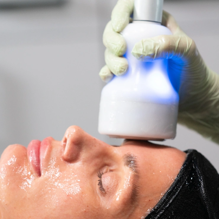 Neveskin Facial